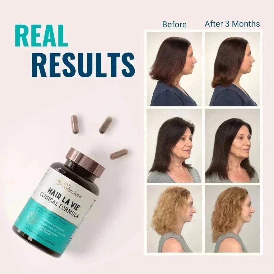 Hair La Vie Clinical Formula Hair Growth Vitamins for Women 1 Pack Fast Shipping Fit And Glow